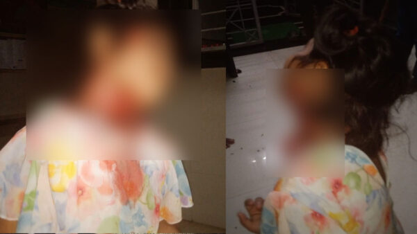 गोंदिया: छह वर्षीय बच्ची पर तेंदुए का हमला, गंभीर रूप से घायल; अर्जुनी/मोरगांव तहसील के गोठनगांव की घटना